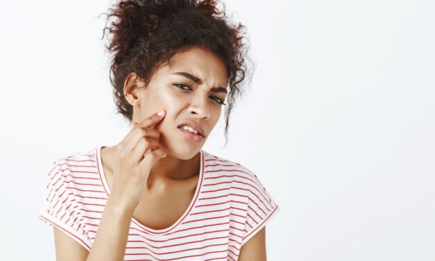 5 Effective Tips for Managing Oily Skin and Embracing a Radiant Complexion