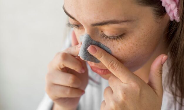 5 Effective Ways to Remove Blackheads for Clear and Radiant Skin